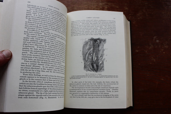The Classics of Medicine Library "Diseases of the Skin" Moriz Kaposi Leather Bound Reprint of 1895 Classic Work