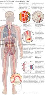 IMPORTANT CLASS - "The New Quiet Epidemic"  LONG COVID - Effective Therapies and Approaches That Have Worked