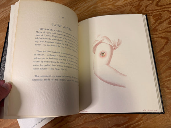 The Causes and Effects of the Variolae Vaccinae The Classics of Medicine Library - Beautiful Leather Bound Reprint of the Classic 1798 Work