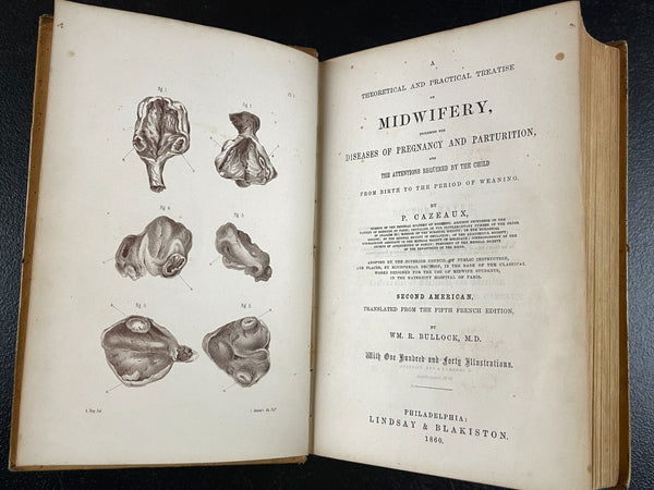 VERY RARE - 1860 Cazeaux's Midwifery, Pregnancy Illus. Medicine Medical Leather Bound Book