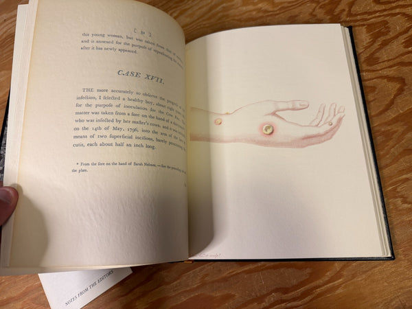 The Causes and Effects of the Variolae Vaccinae The Classics of Medicine Library - Beautiful Leather Bound Reprint of the Classic 1798 Work