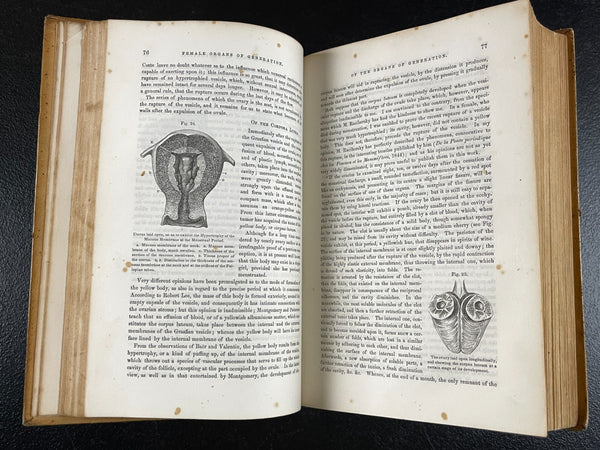 VERY RARE - 1860 Cazeaux's Midwifery, Pregnancy Illus. Medicine Medical Leather Bound Book