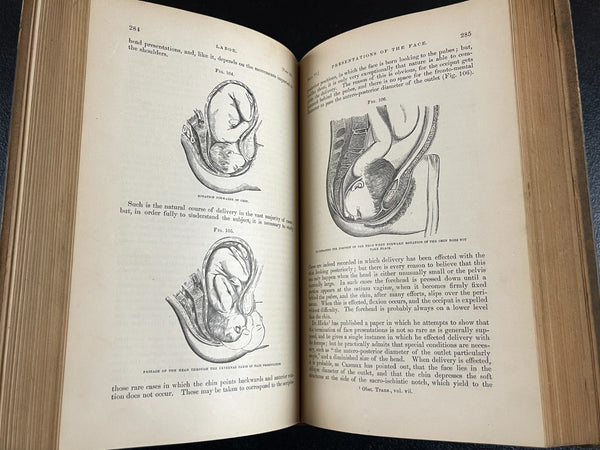 1876 Midwifery 1st, Playfair, Pregnancy Birth Obstetrics, Leather Medical Book - RARE