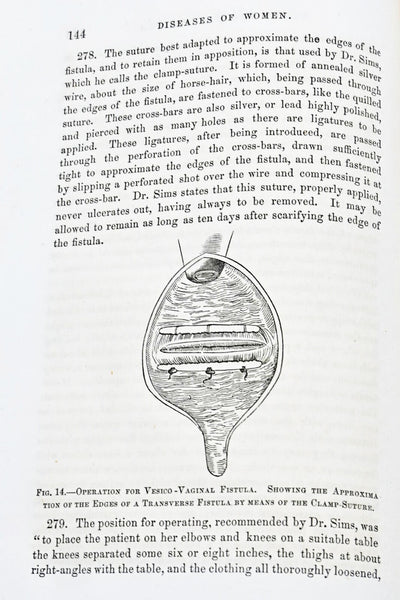 Eclectic JOHN SCUDDER - A Practical Treatise on the Diseases of Women - original 1871 - An Early Eclectic Medicine Work