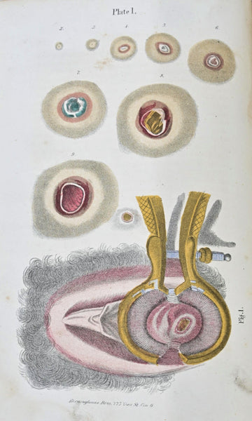 Eclectic JOHN SCUDDER - A Practical Treatise on the Diseases of Women - original 1871 - An Early Eclectic Medicine Work