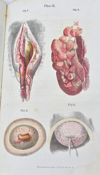 Eclectic JOHN SCUDDER - A Practical Treatise on the Diseases of Women - original 1871 - An Early Eclectic Medicine Work